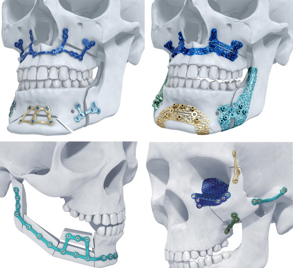 Materialise3DӡֲＴ